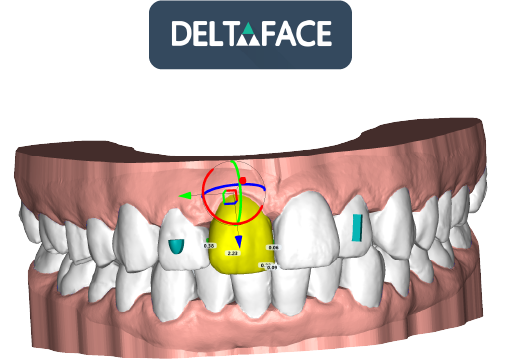 Commercialisation du logiciel DELTAFACE par Nativitas Médical
