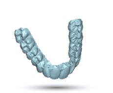 Fournisseur de logiciel pour gouttière invisible orthodontique Nativitas Médical